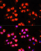 Immunofluorescence analysis of HeLa cells using HOXB9 antibody (13-514) at dilution of 1:100 (40x lens) . Blue: DAPI for nuclear staining.