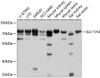 Western blot analysis of extracts of various cell lines, using SLC11A2 antibody (13-520) at 1:1000 dilution.<br/>Secondary antibody: HRP Goat Anti-Rabbit IgG (H+L) at 1:10000 dilution.<br/>Lysates/proteins: 25ug per lane.<br/>Blocking buffer: 3% nonfat dry milk in TBST.<br/>Detection: ECL Basic Kit.<br/>Exposure time: 5s.