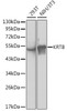 Western blot analysis of extracts of various cell lines, using KRT8 antibody (13-522) at 1:1000 dilution.<br/>Secondary antibody: HRP Goat Anti-Rabbit IgG (H+L) at 1:10000 dilution.<br/>Lysates/proteins: 25ug per lane.<br/>Blocking buffer: 3% nonfat dry milk in TBST.
