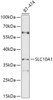 Western blot analysis of extracts of BT-474 cells, using SLC10A1 antibody (13-526) at 1:1000 dilution.<br/>Secondary antibody: HRP Goat Anti-Rabbit IgG (H+L) at 1:10000 dilution.<br/>Lysates/proteins: 25ug per lane.<br/>Blocking buffer: 3% nonfat dry milk in TBST.<br/>Detection: ECL Basic Kit.<br/>Exposure time: 2min.