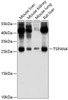 Western blot analysis of extracts of various cell lines, using TSPAN4 antibody (13-534) at 1:1000 dilution.<br/>Secondary antibody: HRP Goat Anti-Rabbit IgG (H+L) at 1:10000 dilution.<br/>Lysates/proteins: 25ug per lane.<br/>Blocking buffer: 3% nonfat dry milk in TBST.<br/>Detection: ECL Basic Kit.<br/>Exposure time: 15s.