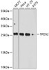 Western blot analysis of extracts of various cell lines, using TPD52 antibody (13-535) at 1:1000 dilution.<br/>Secondary antibody: HRP Goat Anti-Rabbit IgG (H+L) at 1:10000 dilution.<br/>Lysates/proteins: 25ug per lane.<br/>Blocking buffer: 3% nonfat dry milk in TBST.<br/>Detection: ECL Basic Kit.<br/>Exposure time: 10s.