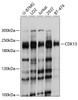 Western blot analysis of extracts of various cell lines, using CDK13 antibody (13-538) at 1:1000 dilution.<br/>Secondary antibody: HRP Goat Anti-Rabbit IgG (H+L) at 1:10000 dilution.<br/>Lysates/proteins: 25ug per lane.<br/>Blocking buffer: 3% nonfat dry milk in TBST.<br/>Detection: ECL Basic Kit.<br/>Exposure time: 1s.