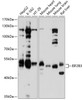 Western blot analysis of extracts of various cell lines, using EIF2B3 antibody (13-543) at 1:1000 dilution.<br/>Secondary antibody: HRP Goat Anti-Rabbit IgG (H+L) at 1:10000 dilution.<br/>Lysates/proteins: 25ug per lane.<br/>Blocking buffer: 3% nonfat dry milk in TBST.<br/>Detection: ECL Basic Kit.<br/>Exposure time: 10s.