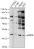 Western blot analysis of extracts of various cell lines, using HTR3B antibody (13-546) at 1:1000 dilution.<br/>Secondary antibody: HRP Goat Anti-Rabbit IgG (H+L) at 1:10000 dilution.<br/>Lysates/proteins: 25ug per lane.<br/>Blocking buffer: 3% nonfat dry milk in TBST.<br/>Detection: ECL Basic Kit.<br/>Exposure time: 10s.