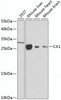 Western blot analysis of extracts of various cell lines, using CA1 antibody (13-570) at 1:1000 dilution.<br/>Secondary antibody: HRP Goat Anti-Rabbit IgG (H+L) at 1:10000 dilution.<br/>Lysates/proteins: 25ug per lane.<br/>Blocking buffer: 3% nonfat dry milk in TBST.<br/>Detection: ECL Basic Kit.<br/>Exposure time: 30s.