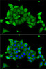 Immunofluorescence analysis of A-549 cells using CA1 antibody (13-570) . Blue: DAPI for nuclear staining.