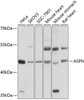 Western blot analysis of extracts of various cell lines, using ASPN antibody (13-571) at 1:1000 dilution.<br/>Secondary antibody: HRP Goat Anti-Rabbit IgG (H+L) at 1:10000 dilution.<br/>Lysates/proteins: 25ug per lane.<br/>Blocking buffer: 3% nonfat dry milk in TBST.<br/>Detection: ECL Basic Kit.<br/>Exposure time: 10s.