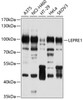 Western blot analysis of extracts of various cell lines, using LEPRE1 antibody (13-580) at 1:1000 dilution.<br/>Secondary antibody: HRP Goat Anti-Rabbit IgG (H+L) at 1:10000 dilution.<br/>Lysates/proteins: 25ug per lane.<br/>Blocking buffer: 3% nonfat dry milk in TBST.<br/>Detection: ECL Basic Kit.<br/>Exposure time: 30s.