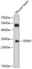 Western blot analysis of extracts of mouse heart, using SPSB1 antibody (13-581) at 1:1000 dilution.<br/>Secondary antibody: HRP Goat Anti-Rabbit IgG (H+L) at 1:10000 dilution.<br/>Lysates/proteins: 25ug per lane.<br/>Blocking buffer: 3% nonfat dry milk in TBST.<br/>Detection: ECL Enhanced Kit.<br/>Exposure time: 90s.