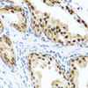 Immunohistochemistry of paraffin-embedded human prostate using RAD23B antibody (13-590) at dilution of 1:100 (40x lens) .