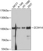 Western blot analysis of extracts of various cell lines, using ZC3H14 antibody (13-607) at 1:1000 dilution.<br/>Secondary antibody: HRP Goat Anti-Rabbit IgG (H+L) at 1:10000 dilution.<br/>Lysates/proteins: 25ug per lane.<br/>Blocking buffer: 3% nonfat dry milk in TBST.<br/>Detection: ECL Basic Kit.<br/>Exposure time: 1s.