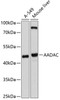 Western blot analysis of extracts of various cell lines, using AADAC antibody (13-608) at 1:1000 dilution.<br/>Secondary antibody: HRP Goat Anti-Rabbit IgG (H+L) at 1:10000 dilution.<br/>Lysates/proteins: 25ug per lane.<br/>Blocking buffer: 3% nonfat dry milk in TBST.<br/>Detection: ECL Basic Kit.<br/>Exposure time: 30s.
