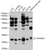 Western blot analysis of extracts of various cell lines, using MTHFD2 antibody (13-620) at 1:1000 dilution.<br/>Secondary antibody: HRP Goat Anti-Rabbit IgG (H+L) at 1:10000 dilution.<br/>Lysates/proteins: 25ug per lane.<br/>Blocking buffer: 3% nonfat dry milk in TBST.<br/>Detection: ECL Basic Kit.<br/>Exposure time: 1s.