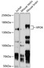 Western blot analysis of extracts of various cell lines, using XPO6 antibody (13-629) at 1:1000 dilution.<br/>Secondary antibody: HRP Goat Anti-Rabbit IgG (H+L) at 1:10000 dilution.<br/>Lysates/proteins: 25ug per lane.<br/>Blocking buffer: 3% nonfat dry milk in TBST.<br/>Detection: ECL Basic Kit.<br/>Exposure time: 5s.