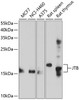 Western blot analysis of extracts of various cell lines, using JTB antibody (13-641) at 1:1000 dilution.<br/>Secondary antibody: HRP Goat Anti-Rabbit IgG (H+L) at 1:10000 dilution.<br/>Lysates/proteins: 25ug per lane.<br/>Blocking buffer: 3% nonfat dry milk in TBST.<br/>Detection: ECL Enhanced Kit.<br/>Exposure time: 60s.