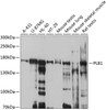 Western blot analysis of extracts of various cell lines, using PLB1 antibody (13-642) at 1:1000 dilution.<br/>Secondary antibody: HRP Goat Anti-Rabbit IgG (H+L) at 1:10000 dilution.<br/>Lysates/proteins: 25ug per lane.<br/>Blocking buffer: 3% nonfat dry milk in TBST.<br/>Detection: ECL Basic Kit.<br/>Exposure time: 5s.