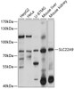 Western blot analysis of extracts of various cell lines, using SLC22A9 antibody (13-646) at 1:1000 dilution.<br/>Secondary antibody: HRP Goat Anti-Rabbit IgG (H+L) at 1:10000 dilution.<br/>Lysates/proteins: 25ug per lane.<br/>Blocking buffer: 3% nonfat dry milk in TBST.<br/>Detection: ECL Basic Kit.<br/>Exposure time: 10s.