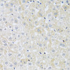 Immunohistochemistry of paraffin-embedded rat liver using SLC4A5 antibody (13-648) at dilution of 1:100 (40x lens) .