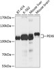Western blot analysis of extracts of various cell lines, using PEX6 antibody (13-664) at 1:1000 dilution.<br/>Secondary antibody: HRP Goat Anti-Rabbit IgG (H+L) at 1:10000 dilution.<br/>Lysates/proteins: 25ug per lane.<br/>Blocking buffer: 3% nonfat dry milk in TBST.<br/>Detection: ECL Basic Kit.<br/>Exposure time: 5s.