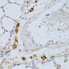 Immunohistochemistry of paraffin-embedded rat lung using PHGDH antibody (13-666) at dilution of 1:100 (40x lens) .