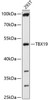 Western blot analysis of extracts of 293T cells, using TBX19 antibody (13-678) at 1:1000 dilution.<br/>Secondary antibody: HRP Goat Anti-Rabbit IgG (H+L) at 1:10000 dilution.<br/>Lysates/proteins: 25ug per lane.<br/>Blocking buffer: 3% nonfat dry milk in TBST.<br/>Detection: ECL Basic Kit.<br/>Exposure time: 30s.