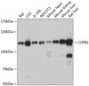 Western blot analysis of extracts of various cell lines, using COPB1 antibody (13-680) at 1:1000 dilution.<br/>Secondary antibody: HRP Goat Anti-Rabbit IgG (H+L) at 1:10000 dilution.<br/>Lysates/proteins: 25ug per lane.<br/>Blocking buffer: 3% nonfat dry milk in TBST.<br/>Detection: ECL Basic Kit.<br/>Exposure time: 1s.