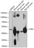 Western blot analysis of extracts of various cell lines, using CPB1 antibody (13-681) at 1:1000 dilution.<br/>Secondary antibody: HRP Goat Anti-Rabbit IgG (H+L) at 1:10000 dilution.<br/>Lysates/proteins: 25ug per lane.<br/>Blocking buffer: 3% nonfat dry milk in TBST.<br/>Detection: ECL Basic Kit.<br/>Exposure time: 5s.