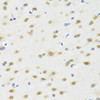 Immunohistochemistry of paraffin-embedded rat brain using MTAP antibody (13-684) at dilution of 1:100 (40x lens) .