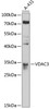 Western blot analysis of extracts of A-431 cells, using VDAC3 antibody (13-710) at 1:1000 dilution.<br/>Secondary antibody: HRP Goat Anti-Rabbit IgG (H+L) at 1:10000 dilution.<br/>Lysates/proteins: 25ug per lane.<br/>Blocking buffer: 3% nonfat dry milk in TBST.<br/>Detection: ECL Basic Kit.<br/>Exposure time: 5s.