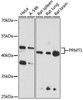 Western blot analysis of extracts of various cell lines, using PRMT1 antibody (13-714) at 1:1000 dilution.<br/>Secondary antibody: HRP Goat Anti-Rabbit IgG (H+L) at 1:10000 dilution.<br/>Lysates/proteins: 25ug per lane.<br/>Blocking buffer: 3% nonfat dry milk in TBST.<br/>Detection: ECL Basic Kit.<br/>Exposure time: 90s.