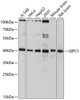 Western blot analysis of extracts of various cell lines, using GIPC1 antibody (13-715) at 1:3000 dilution.<br/>Secondary antibody: HRP Goat Anti-Rabbit IgG (H+L) at 1:10000 dilution.<br/>Lysates/proteins: 25ug per lane.<br/>Blocking buffer: 3% nonfat dry milk in TBST.<br/>Detection: ECL Basic Kit.<br/>Exposure time: 10s.