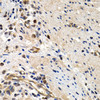 Immunohistochemistry of paraffin-embedded human colon using MCM2 antibody (13-723) at dilution of 1:200 (40x lens) .