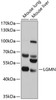 Western blot analysis of extracts of various cell lines, using LGMN antibody (13-728) at 1:1000 dilution.<br/>Secondary antibody: HRP Goat Anti-Rabbit IgG (H+L) at 1:10000 dilution.<br/>Lysates/proteins: 25ug per lane.<br/>Blocking buffer: 3% nonfat dry milk in TBST.<br/>Detection: ECL Basic Kit.<br/>Exposure time: 1s.