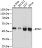 Western blot analysis of extracts of various cell lines, using RCN1 antibody (13-730) at 1:1000 dilution.<br/>Secondary antibody: HRP Goat Anti-Rabbit IgG (H+L) at 1:10000 dilution.<br/>Lysates/proteins: 25ug per lane.<br/>Blocking buffer: 3% nonfat dry milk in TBST.<br/>Detection: ECL Basic Kit.<br/>Exposure time: 1s.