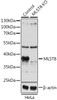 Western blot analysis of extracts from normal (control) and MLST8 knockout (KO) HeLa cells, using MLST8 antibody (13-744) at 1:1000 dilution.<br/>Secondary antibody: HRP Goat Anti-Rabbit IgG (H+L) at 1:10000 dilution.<br/>Lysates/proteins: 25ug per lane.<br/>Blocking buffer: 3% nonfat dry milk in TBST.<br/>Detection: ECL Basic Kit.<br/>Exposure time: 5s.