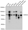 Western blot analysis of extracts of various cell lines, using WDR26 antibody (13-748) at 1:1000 dilution.<br/>Secondary antibody: HRP Goat Anti-Rabbit IgG (H+L) at 1:10000 dilution.<br/>Lysates/proteins: 25ug per lane.<br/>Blocking buffer: 3% nonfat dry milk in TBST.<br/>Detection: ECL Basic Kit.<br/>Exposure time: 5s.