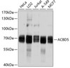 Western blot analysis of extracts of various cell lines, using ACBD5 antibody (13-749) at 1:1000 dilution.<br/>Secondary antibody: HRP Goat Anti-Rabbit IgG (H+L) at 1:10000 dilution.<br/>Lysates/proteins: 25ug per lane.<br/>Blocking buffer: 3% nonfat dry milk in TBST.<br/>Detection: ECL Basic Kit.<br/>Exposure time: 1s.