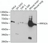 Western blot analysis of extracts of various cell lines, using PPP3CA antibody (13-765) at 1:1000 dilution.<br/>Secondary antibody: HRP Goat Anti-Rabbit IgG (H+L) at 1:10000 dilution.<br/>Lysates/proteins: 25ug per lane.<br/>Blocking buffer: 3% nonfat dry milk in TBST.