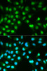 Immunofluorescence analysis of HeLa cells using PPP3CA antibody (13-765) . Blue: DAPI for nuclear staining.