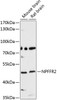 Western blot analysis of extracts of various cell lines, using NPFFR2 antibody (13-768) at 1:3000 dilution.<br/>Secondary antibody: HRP Goat Anti-Rabbit IgG (H+L) at 1:10000 dilution.<br/>Lysates/proteins: 25ug per lane.<br/>Blocking buffer: 3% nonfat dry milk in TBST.<br/>Detection: ECL Basic Kit.<br/>Exposure time: 90s.