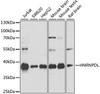 Western blot analysis of extracts of various cell lines, using HNRNPDL antibody (13-773) at 1:1000 dilution.<br/>Secondary antibody: HRP Goat Anti-Rabbit IgG (H+L) at 1:10000 dilution.<br/>Lysates/proteins: 25ug per lane.<br/>Blocking buffer: 3% nonfat dry milk in TBST.<br/>Detection: ECL Basic Kit.<br/>Exposure time: 30s.