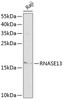 Western blot analysis of extracts of Raji cells, using RNASE13 antibody (13-774) at 1:1000 dilution.<br/>Secondary antibody: HRP Goat Anti-Rabbit IgG (H+L) at 1:10000 dilution.<br/>Lysates/proteins: 25ug per lane.<br/>Blocking buffer: 3% nonfat dry milk in TBST.