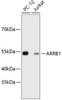 Western blot analysis of extracts of various cell lines, using ARRB1 antibody (13-780) .<br/>Secondary antibody: HRP Goat Anti-Rabbit IgG (H+L) at 1:10000 dilution.<br/>Lysates/proteins: 25ug per lane.<br/>Blocking buffer: 3% nonfat dry milk in TBST.
