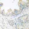 Immunohistochemistry of paraffin-embedded human prostate using CUL3 antibody (13-797) at dilution of 1:100 (40x lens) .