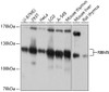 Western blot analysis of extracts of various cell lines, using RBM5 antibody (13-803) at 1:1000 dilution.<br/>Secondary antibody: HRP Goat Anti-Rabbit IgG (H+L) at 1:10000 dilution.<br/>Lysates/proteins: 25ug per lane.<br/>Blocking buffer: 3% nonfat dry milk in TBST.<br/>Detection: ECL Basic Kit.<br/>Exposure time: 30s.
