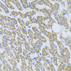 Immunohistochemistry of paraffin-embedded human liver damage using NTF4 antibody (13-810) at dilution of 1:100 (40x lens) .