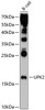 Western blot analysis of extracts of B-cell cells, using UPK2 antibody (13-812) at 1:1000 dilution.<br/>Secondary antibody: HRP Goat Anti-Rabbit IgG (H+L) at 1:10000 dilution.<br/>Lysates/proteins: 25ug per lane.<br/>Blocking buffer: 3% nonfat dry milk in TBST.<br/>Detection: ECL Enhanced Kit.<br/>Exposure time: 40s.
