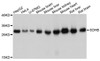 Western blot analysis of extracts of various cell lines, using SDHB antibody (13-817) at 1:1000 dilution.<br/>Secondary antibody: HRP Goat Anti-Rabbit IgG (H+L) at 1:10000 dilution.<br/>Lysates/proteins: 25ug per lane.<br/>Blocking buffer: 3% nonfat dry milk in TBST.<br/>Detection: ECL Basic Kit.<br/>Exposure time: 1s.