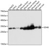 Immunohistochemistry of paraffin-embedded human colon using SDHB antibody (13-817) at dilution of 1:100 (40x lens) .